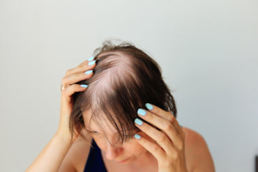 How Hormones Affect Female Hair Loss