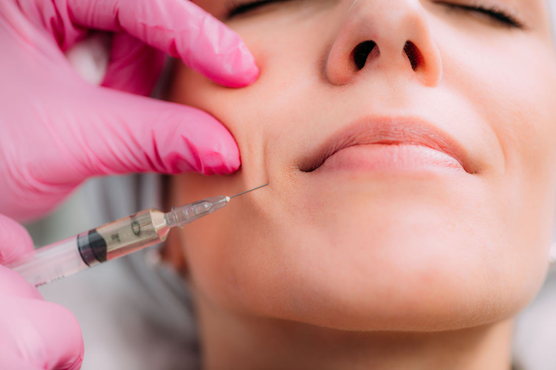 10 Details to Fill You in on Facial Fillers